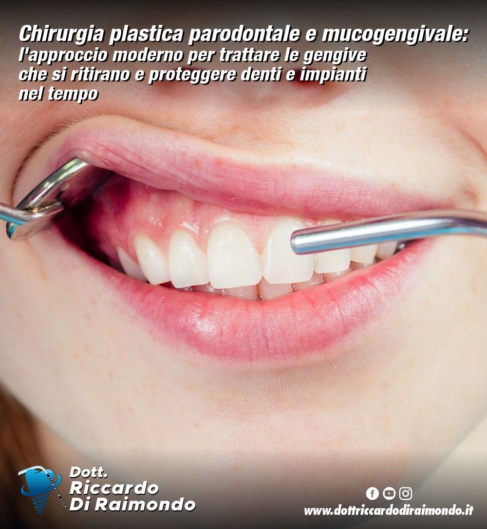 Chirurgia plastica parodontale e mucogengivale: l'approccio moderno per trattare le gengive che si ritirano e proteggere denti e impianti nel tempo