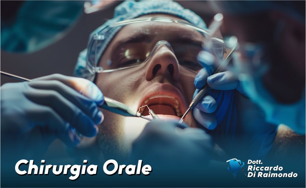 Chirurgia Orale