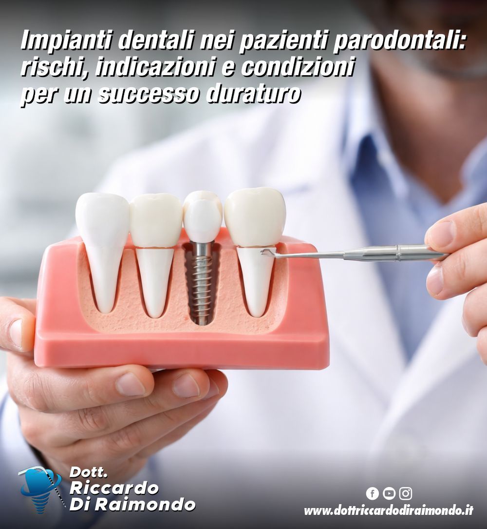 Impianti dentali nei pazienti parodontali: rischi, indicazioni e condizioni per un successo duraturo