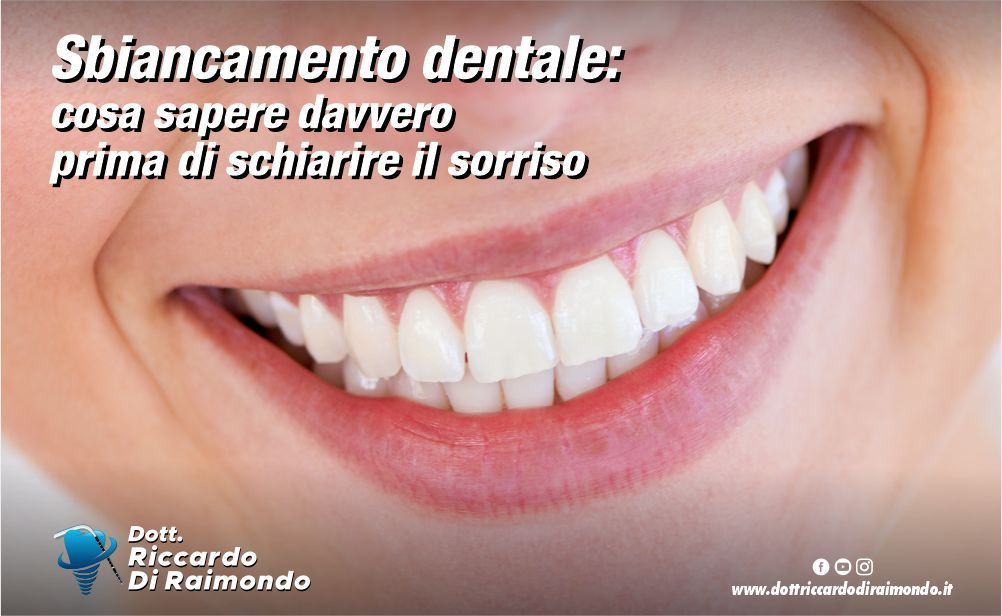 Articolo Blog Dott. Riccardo Di Raimondo - Dentista specializzato in implantologia e parodontologia a Palermo.