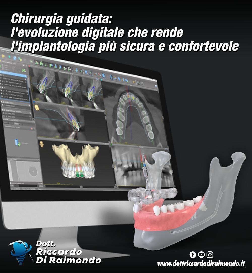 Chirurgia guidata: l'evoluzione digitale che rende l'implantologia più sicura e confortevole