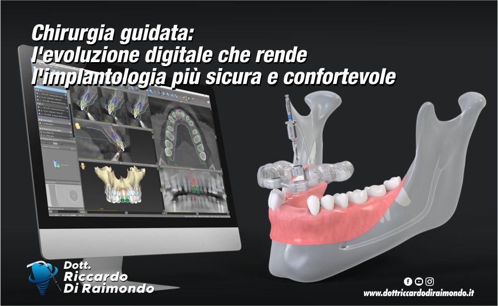 Chirurgia guidata: l'evoluzione digitale che rende l'implantologia più sicura e confortevole