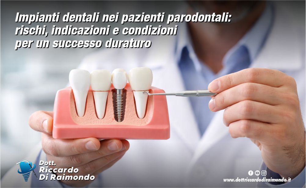 Articolo Blog Dott. Riccardo Di Raimondo - Dentista specializzato in implantologia e parodontologia a Palermo.