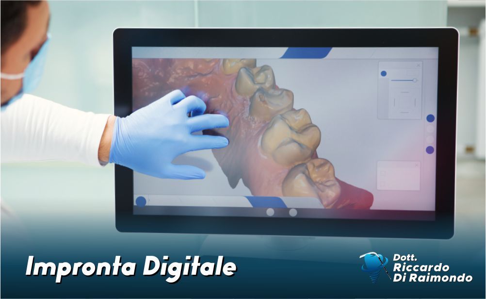Impronta Digitale