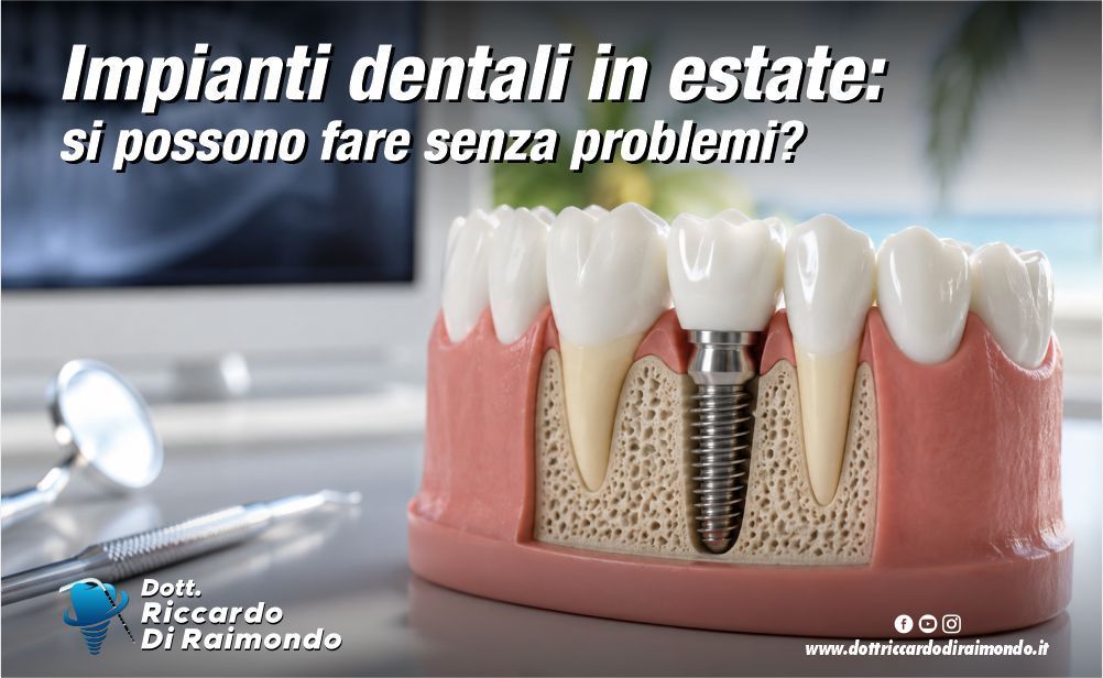 Articolo Blog Dott. Riccardo Di Raimondo - Dentista specializzato in implantologia e parodontologia a Palermo.