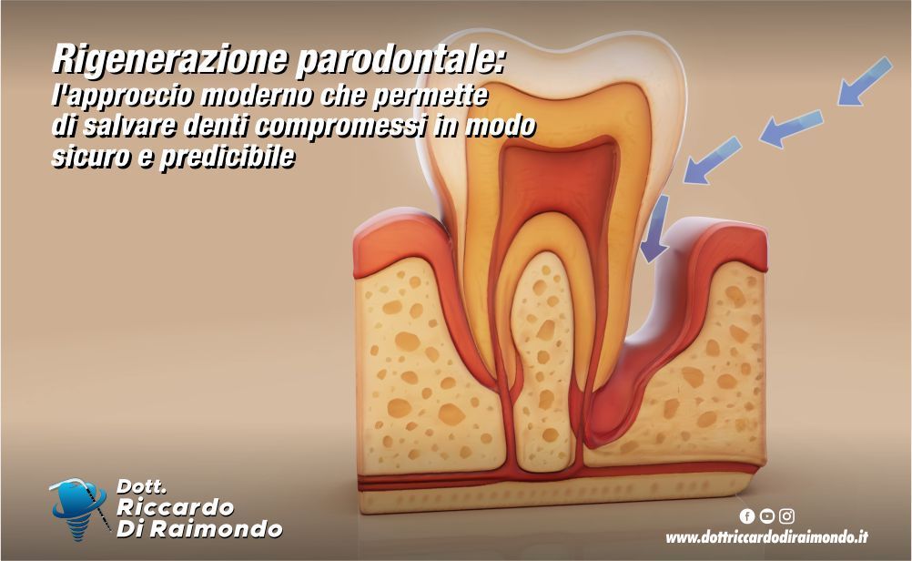 Articolo Blog Dott. Riccardo Di Raimondo - Dentista specializzato in implantologia e parodontologia a Palermo.