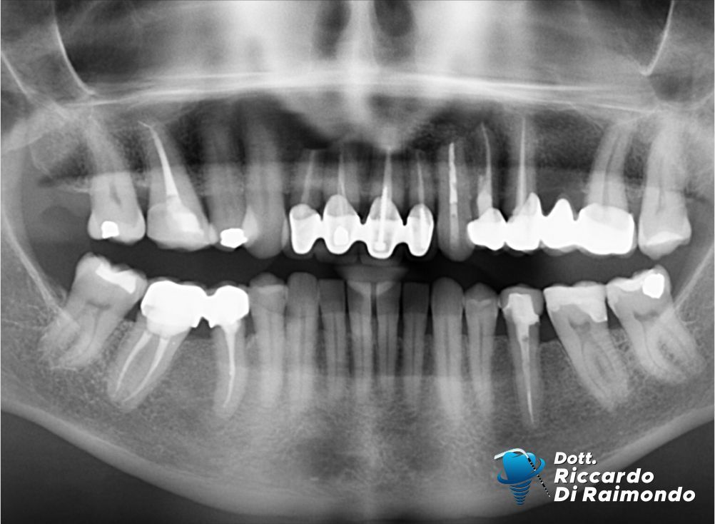 Prima del trattamento di Chirurgia Orale