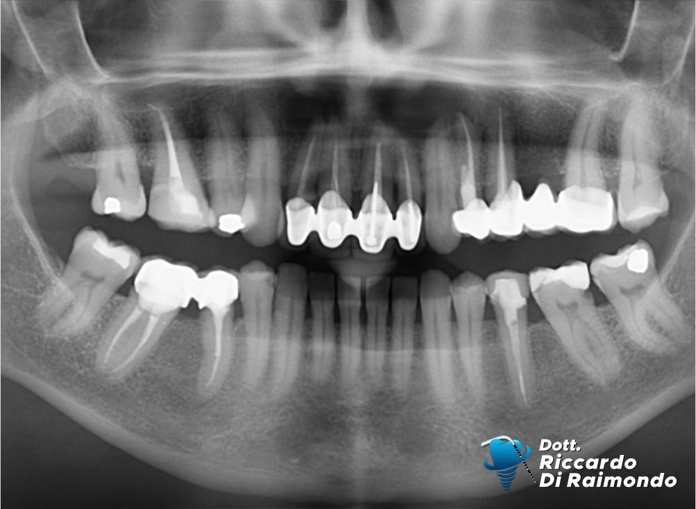 Prima del trattamento di Chirurgia Orale