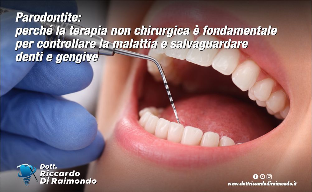 Articolo Blog Dott. Riccardo Di Raimondo - Dentista specializzato in implantologia e parodontologia a Palermo.
