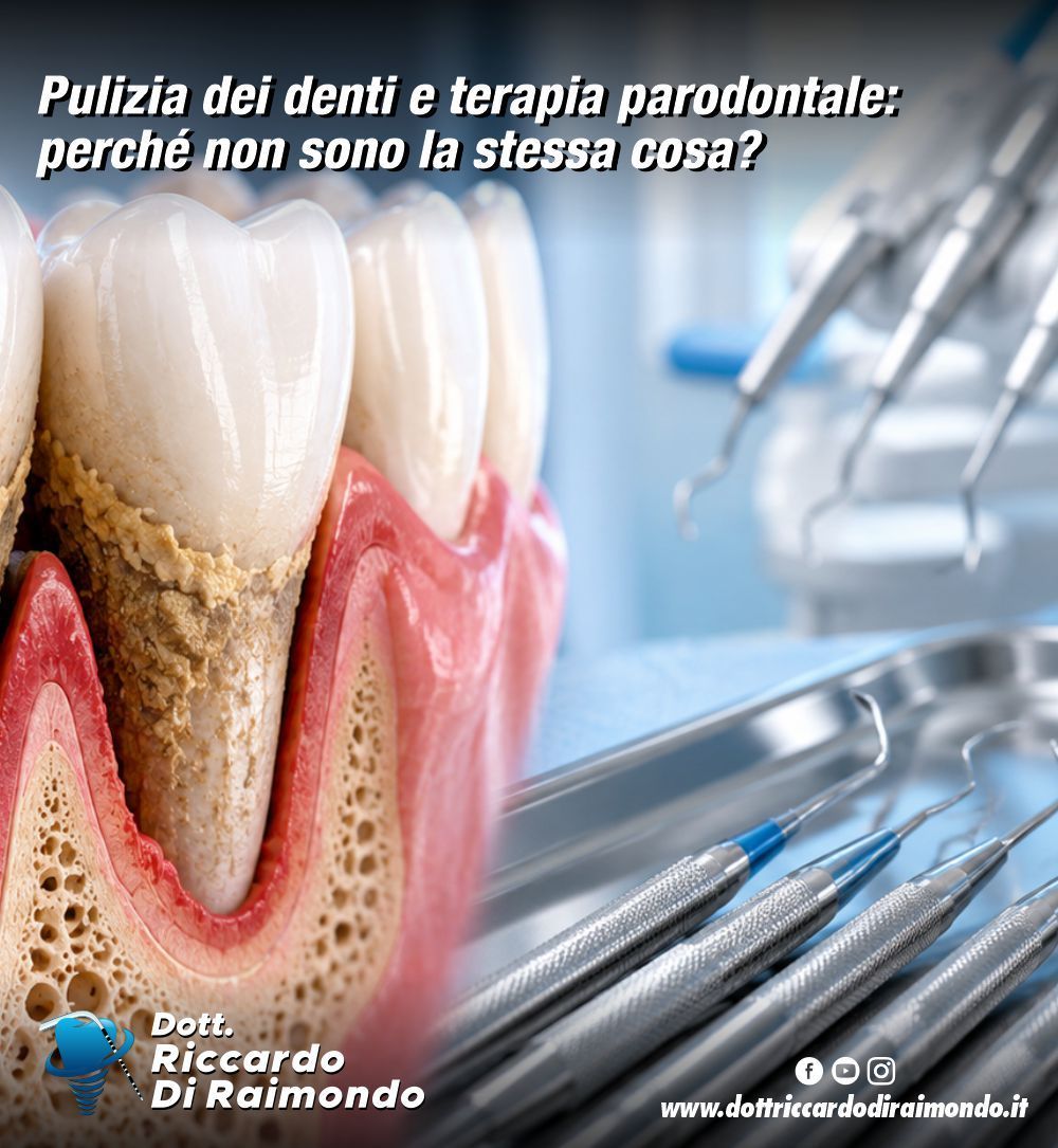 Pulizia dei denti e terapia parodontale: perché non sono la stessa cosa?